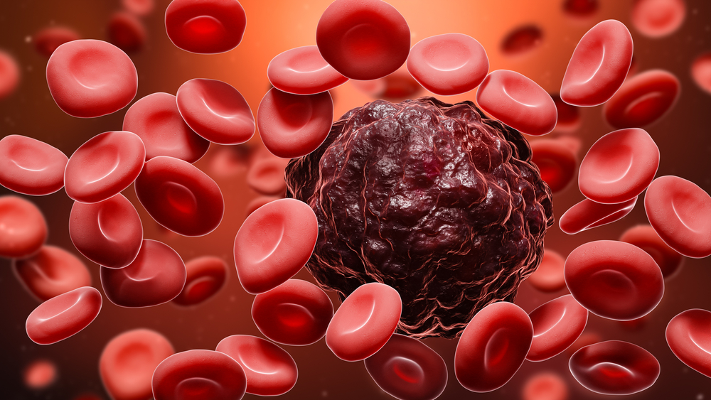 Blood Cancer Types, causes and symptoms Laredo Emergency Room